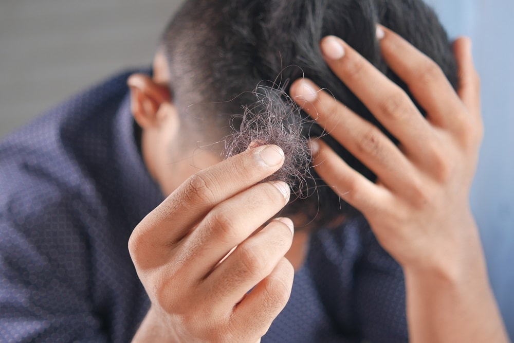 caída del cabello después del covid 19 clínica capilar ercilla